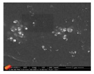 SEM micrographs of PNIPAM — ZnO nanocomposites with 0.2, % Zn O